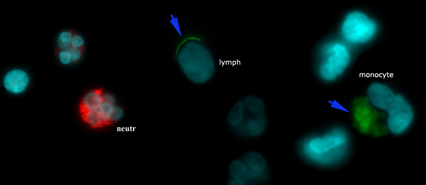на фото представлены иммуноциты (указать какие именно?) человека, зелёное и красное свечение соответствует локализации меченого флюорохромом  Аллостатина®1.
